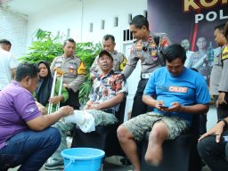 Sambut Hari Bhayangkara Ke-78, Polresta Malang Kota Beri Kaki Palsu Untuk Puluhan Disabilitas